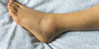 7 წესი, თუ რა უნდა ქნათ ფეხების შეშუპების დროს! ეს აუცილებლად დაგეხმარებათ!