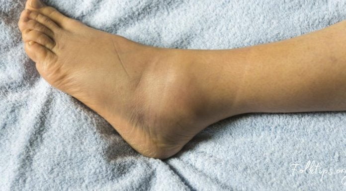 7 წესი, თუ რა უნდა ქნათ ფეხების შეშუპების დროს! ეს აუცილებლად დაგეხმარებათ!