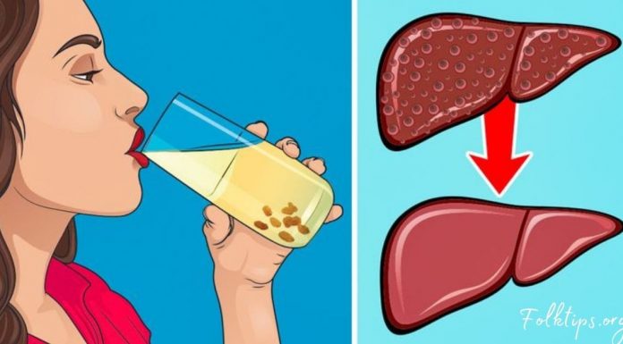 აი, როგორ უნდა გაისუფთაოთ ღვიძლი ქიშმიშით 2 დღეში -ეფექტური მეთოდი!