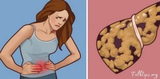 ღვიძლის ცხიმოვანი დაავადება-პირველი სიმპტომები, რომელსაც ყველა აიგნორებს…