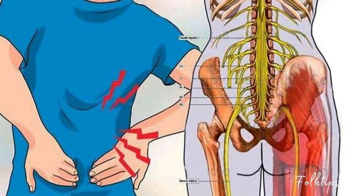 იმკურნალეთ სახლის პირობებში ნერვის ანთების დროს!