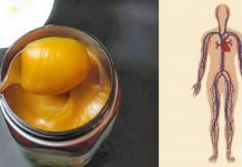 აი, როგორ უნდა მიიღოთ საოცარი შედეგი თაფლით! დაირეგულირეთ წნევა მარტივად…