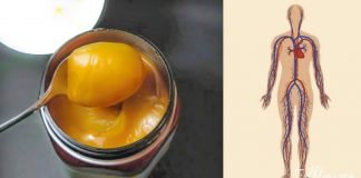 აი, როგორ უნდა მიიღოთ საოცარი შედეგი თაფლით! დაირეგულირეთ წნევა მარტივად…