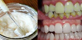 ამ მეთოდის გამოყენებით მარტივად მოიშორებთ ნადებს და გაისუფთავებთ კბილებს-ეფექტურია!