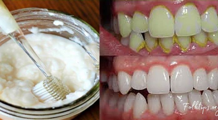 ამ მეთოდის გამოყენებით მარტივად მოიშორებთ ნადებს და გაისუფთავებთ კბილებს-ეფექტურია!