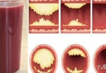 ეს უგემრიელესი წვენი თქვენს არტერიებს გაწმენდს და დაგიცავთ გულის დაავადებებისგან!