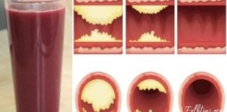 ეს უგემრიელესი წვენი თქვენს არტერიებს გაწმენდს და დაგიცავთ გულის დაავადებებისგან!