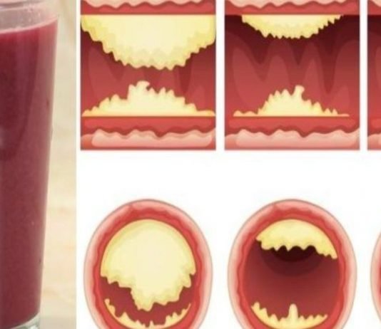 ეს უგემრიელესი წვენი თქვენს არტერიებს გაწმენდს და დაგიცავთ გულის დაავადებებისგან!