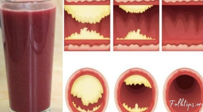 ეს უგემრიელესი წვენი თქვენს არტერიებს გაწმენდს და დაგიცავთ გულის დაავადებებისგან!