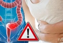 მსხვილი ნაწლავის 7 სიმპტომი, რაც ყველამ უნდა იცოდეს! იზრუნეთ თქვენს ჯანმრთელობაზე!