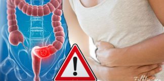 მსხვილი ნაწლავის 7 სიმპტომი, რაც ყველამ უნდა იცოდეს! იზრუნეთ თქვენს ჯანმრთელობაზე!