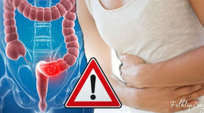 მსხვილი ნაწლავის 7 სიმპტომი, რაც ყველამ უნდა იცოდეს! იზრუნეთ თქვენს ჯანმრთელობაზე!