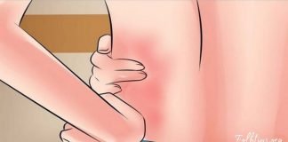 ამ ვიტამინის დეფიციტი სახსრებისა და ზურგის ტკივილს იწვევს-გაეცანით საარგებლო ინფორმაციას!