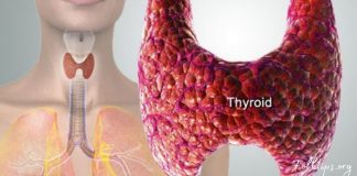 ამ პროდუქტების შემცირებით, თქვენ თავიდან აირიდებთ ფარისებრი ჯირკვლის დაავადებებს!