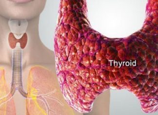 ამ პროდუქტების შემცირებით, თქვენ თავიდან აირიდებთ ფარისებრი ჯირკვლის დაავადებებს!