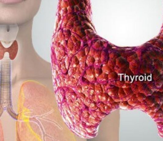 ამ პროდუქტების შემცირებით, თქვენ თავიდან აირიდებთ ფარისებრი ჯირკვლის დაავადებებს!