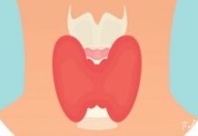 ფარისებრი ჯირკვალთან დაკავშირებული 12 სიმპტომი, რომელიც აუცილებლად უნდა იცოდეთ!