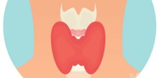 ფარისებრი ჯირკვალთან დაკავშირებული 12 სიმპტომი, რომელიც აუცილებლად უნდა იცოდეთ!