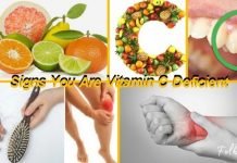 C ვიტამინის დეფიციტის სიპტომები და ნიშნები-სასარგებლო ინფორმაცია!