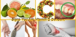 C ვიტამინის დეფიციტის სიპტომები და ნიშნები-სასარგებლო ინფორმაცია!