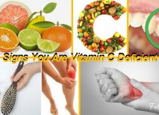 C ვიტამინის დეფიციტის სიპტომები და ნიშნები-სასარგებლო ინფორმაცია!