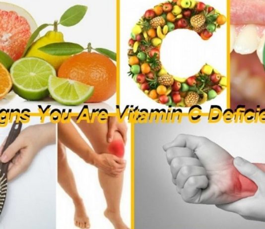C ვიტამინის დეფიციტის სიპტომები და ნიშნები-სასარგებლო ინფორმაცია!