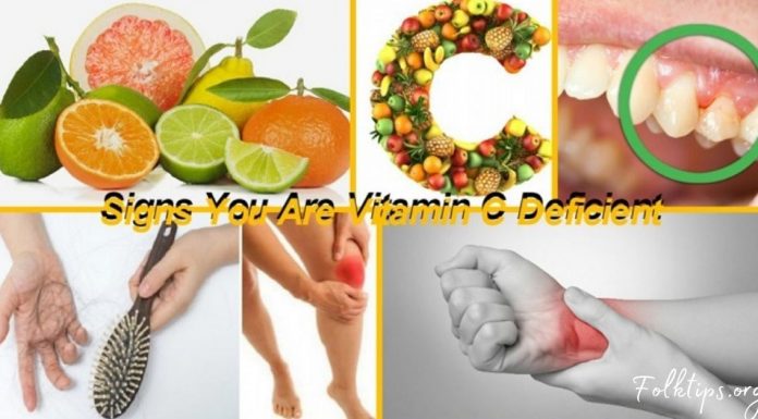 C ვიტამინის დეფიციტის სიპტომები და ნიშნები-სასარგებლო ინფორმაცია!