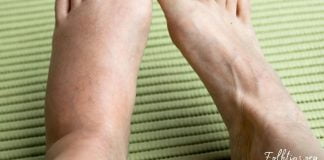 შეშუპებული კიდურების სამკურნალო ბუნებრივი მეთოდები- ეფექტურია!