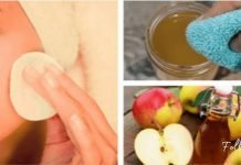 აი რატომ უნდა გავიწმინდოთ სახე ვაშლის ძმრით! ეფექტური და იაფფასიანი მეთოდია!