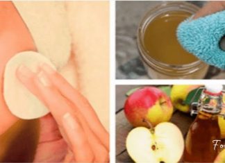 აი რატომ უნდა გავიწმინდოთ სახე ვაშლის ძმრით! ეფექტური და იაფფასიანი მეთოდია!