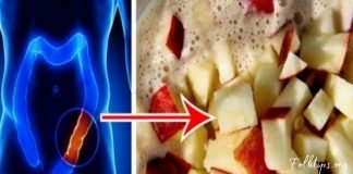 გაასუფთავეთ ნაწლავები ტოქსინებისგან-სცადეთ ყველაზე ეფექტური ბუნებრივი საშუალება!