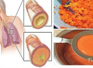 ორინგრედიენტიანი სიროფი, რომელიც ხველას მოგიხსნით და ფილტვებიდან ლორწოს გააქრობს!