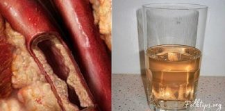 გაისუფთავეთ არტერიები მარტივად- სცადეთ საოცრად ეფექტური სასმელი