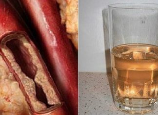 გაისუფთავეთ არტერიები მარტივად- სცადეთ საოცრად ეფექტური სასმელი
