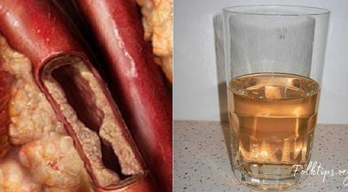 გაისუფთავეთ არტერიები მარტივად- სცადეთ საოცრად ეფექტური სასმელი