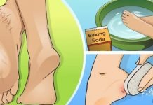 დახეთქილ ქუსლებსა და კოჟრს ის მარტივი ინგრედიენტი შველის, რომელიც ყველას სახლში გვაქვს!