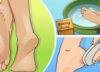 დახეთქილ ქუსლებსა და კოჟრს ის მარტივი ინგრედიენტი შველის, რომელიც ყველას სახლში გვაქვს!