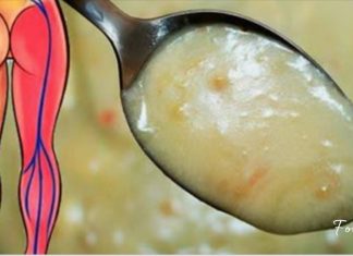 საჯდომის ნერვის ანთება აღარ შეგაწუხებთ, თუ ამ მეთოდებს მიმართავთ. ამოვისუნთქე!