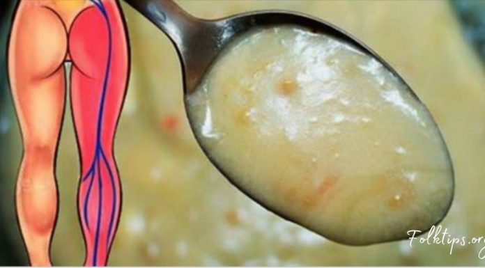 საჯდომის ნერვის ანთება აღარ შეგაწუხებთ, თუ ამ მეთოდებს მიმართავთ. ამოვისუნთქე!