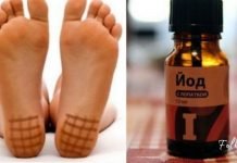 აი როგორ უნდა იოდის ბადის დახატვა ფეხის ქუსლებზე! საინტერესოა…