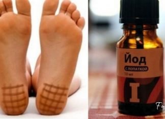 აი როგორ უნდა იოდის ბადის დახატვა ფეხის ქუსლებზე! საინტერესოა…