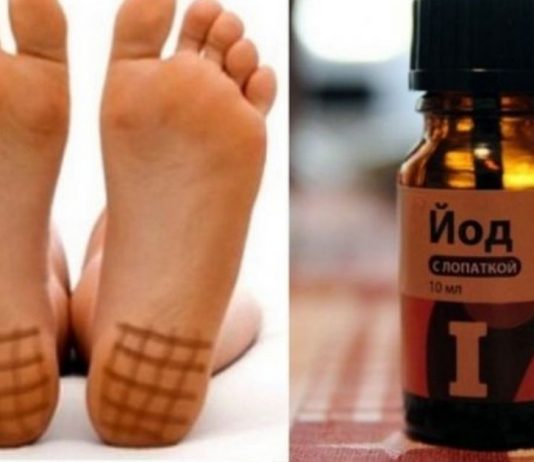 აი როგორ უნდა იოდის ბადის დახატვა ფეხის ქუსლებზე! საინტერესოა…