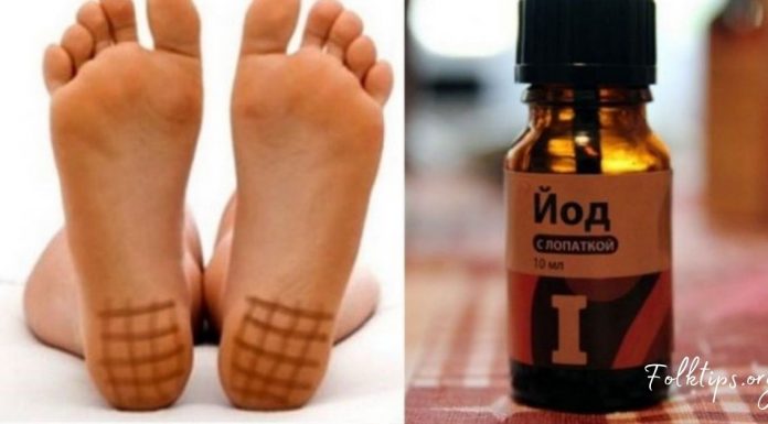 აი როგორ უნდა იოდის ბადის დახატვა ფეხის ქუსლებზე! საინტერესოა…