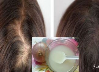 როგორ შევაჩეროთ თმის ცვენა ხახვის გამოყენებით? არ მეგონა ასეთი ეფექტური თუ იქნებოდა…