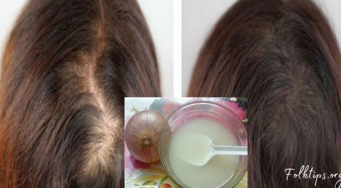 როგორ შევაჩეროთ თმის ცვენა ხახვის გამოყენებით? არ მეგონა ასეთი ეფექტური თუ იქნებოდა…