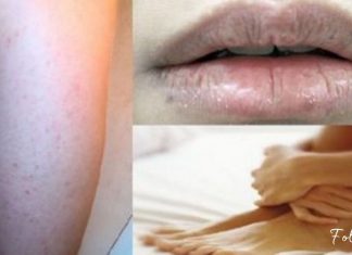 კანი გიშრებათ? თმა გცვივათ? აი, რომელი ვიტამინი გაკლიათ. ეს ყველასთვის საჭიროა