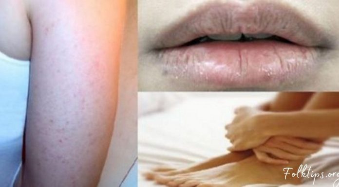 კანი გიშრებათ? თმა გცვივათ? აი, რომელი ვიტამინი გაკლიათ. ეს ყველასთვის საჭიროა