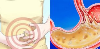 ამის გამოყენების შემდეგ სამუდამოდ დაივიწყებთ გასტრიტს! ეფექტური საშუალება!