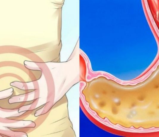 ამის გამოყენების შემდეგ სამუდამოდ დაივიწყებთ გასტრიტს! ეფექტური საშუალება!