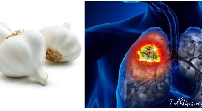 4 პროდუქტი, რომელიც ფილტვებს წმენდს! ეს განსაკუთრებით მწეველებმა უნდა გაითვალისწინონ…